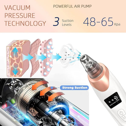 Blackhead Remover Vacuum