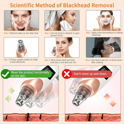 Blackhead Remover Vacuum